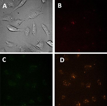 Microscopic images of control cells (treated only with transfection reagent). Microscopic images of control cells (treated only with transfection reagent).