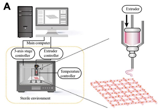 Workflow 3D printed breast cancer model An illustration of the workflow for 3D printed breast cancer model, starting with 2D image of the model in the main computer which feeds the required information to a printer kept in a sterile environment  with a blown-up version of the extruder nozzle in the printer shown extruding a 2-D shape into a 3-D object.