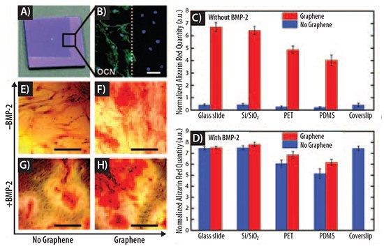 Graphene accelerates bone cell differentiation Graphene accelerates bone cell differentiation