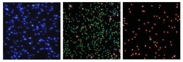 Dark field microscopy Dark field microscopy
