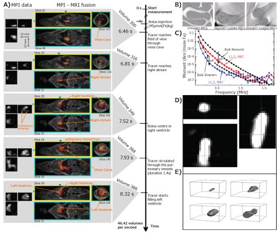 MPI,  MPI-MRI and TEM images MPI,  MPI-MRI and TEM images