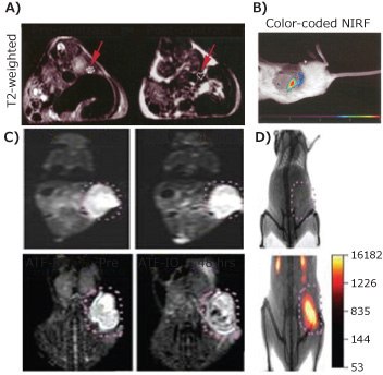 MRI-near Infrared (NIR) Optical Imaging MRI-near Infrared (NIR) Optical Imaging