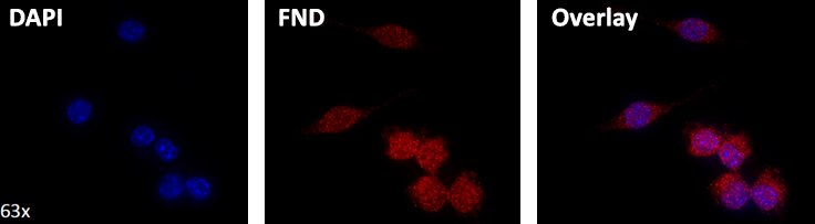 Streptavidin functionalized 40 nm fluorescent nanodiamond containing NV centers (~2 ppm) targeting a biotinylated intracellular target, with comparison and overlay to DAPI (4’,6-diamidino-2-phenylindole) stained nuclei. Streptavidin functionalized 40 nm fluorescent nanodiamond containing NV centers (~2 ppm) targeting a biotinylated intracellular target, with comparison and overlay to DAPI (4’,6-diamidino-2-phenylindole) stained nuclei.