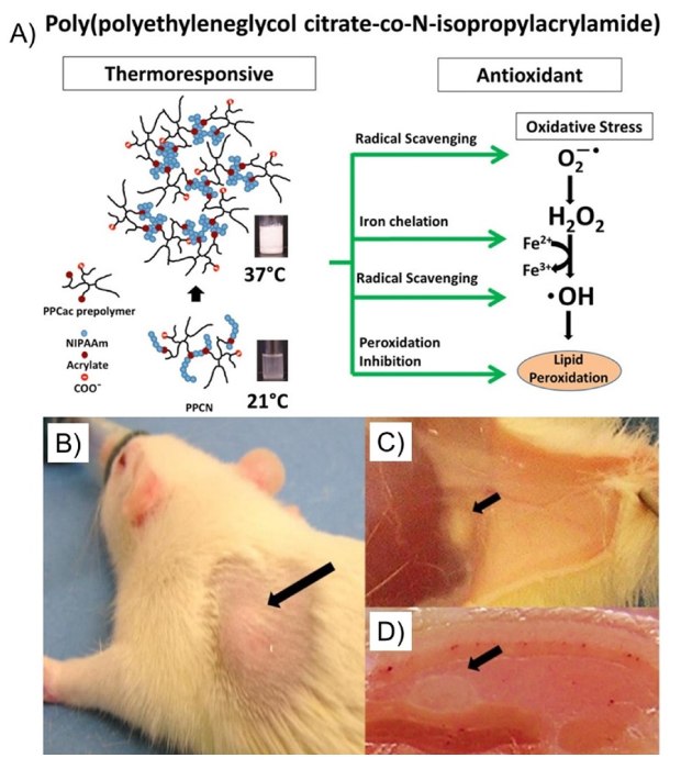 Schematic of poly(polyethylene glycol citrate-co-N-isopropylacrylamide) gel formation and antioxidant properties Schematic of thermoresponsive poly(polyetheylene glycol citrate-co-N-isopropylacrylamide) gel formation and antioxidant properites