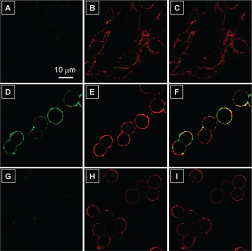 Confocal laser scanning microscopy (CLSM) images of live cells after incubation with 2 μM TPS-2cRGD in the absence and presence of a membrane tracker (62.5 ng mL<sup>−1</sup>) for 30 min at 4 °C. Fluorescence images of (<b>A−C</b>) MCF-7 and (<b>D−F</b>) HT-29 cells stained by (<b>A, D</b>) TPS-2cRGD and (<b>B, E</b>) membrane tracker. Their overlay images were given in (<b>C, F</b>). Fluorescence images of HT-29 cells pretreated with 10 μM cRGD followed by staining by (<b>G</b>) TPS-2cRGD and (<b>H</b>) membrane tracker. (<b>I</b>) was the overlay image of (<b>G</b>) and (<b>H</b>). The images were taken under excitations at (<b>A, D, G</b>) 405 nm and (<b>B, E, H</b>) 543 nm using optical filters with band passes of (<b>A, D, G</b>) 505−525 nm and (<b>B, E, H</b>) 575−635 nm at 5% laser power. All images share the same scale bar (10 μm). Confocal laser scanning microscopy (CLSM) images of live cells after incubation with 2 μM TPS-2cRGD in the absence and presence of a membrane tracker