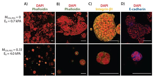 Effects of hydrogel elastic modulus Effects of hydrogel elastic modulus