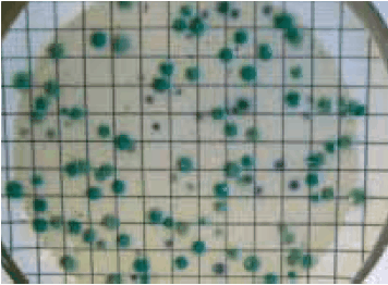 ChromoSelect Agar (C. perfringens appears as green colonies) Figure 2 CP ChromoSelect Agar (C. perfringens appears as green colonies)