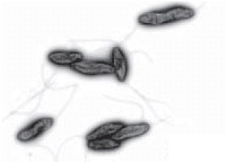 Electron microscope image of Campylobacters Electron microscope image of Campylobacters