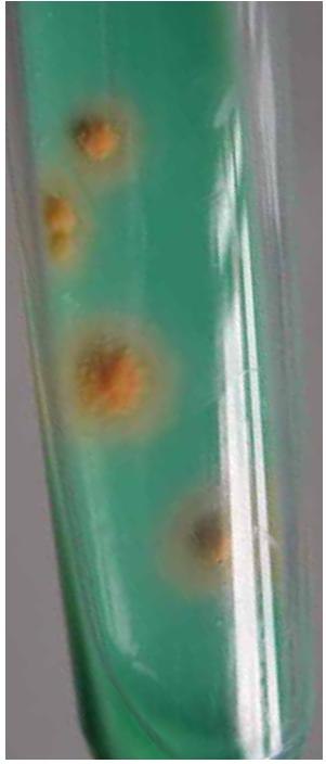 mycobacteria-identification-b Mycobacteria colonies on TB-Medium Base according to Löwenstein-Jensen