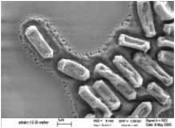 Scanning electron micrograph of C. perfringens grown on a silicon wafer (source: S. Melville, Department of Biological Sciences, Virginia Tech University)  Scanning electron micrograph of C. perfringens grown on a silicon wafer (source: S. Melville, Department of Biological Sciences, Virginia Tech University)