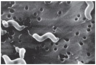 Scanning electron micrograph Scanning electron micrograph