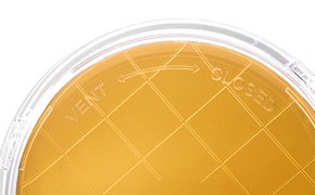 Lid of a culture media contact plate Lid of a culture media contact plate