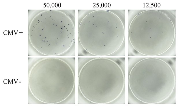 ELISpot assay using CMV-derived peptides to stimulate IFN-γ secretion. ELISpot assay using CMV-derived peptides to stimulate IFN-γ secretion.