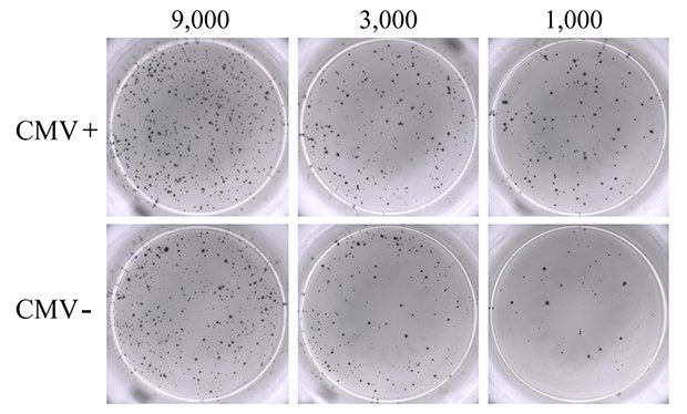 ELISpot assay using 0.3 µM ionomycin + 0.2 µM PMA to stimulate IFN-γ secretion from PBMCs.  ELISpot assay using 0.3 µM ionomycin + 0.2 µM PMA to stimulate IFN-γ secretion from PBMCs.