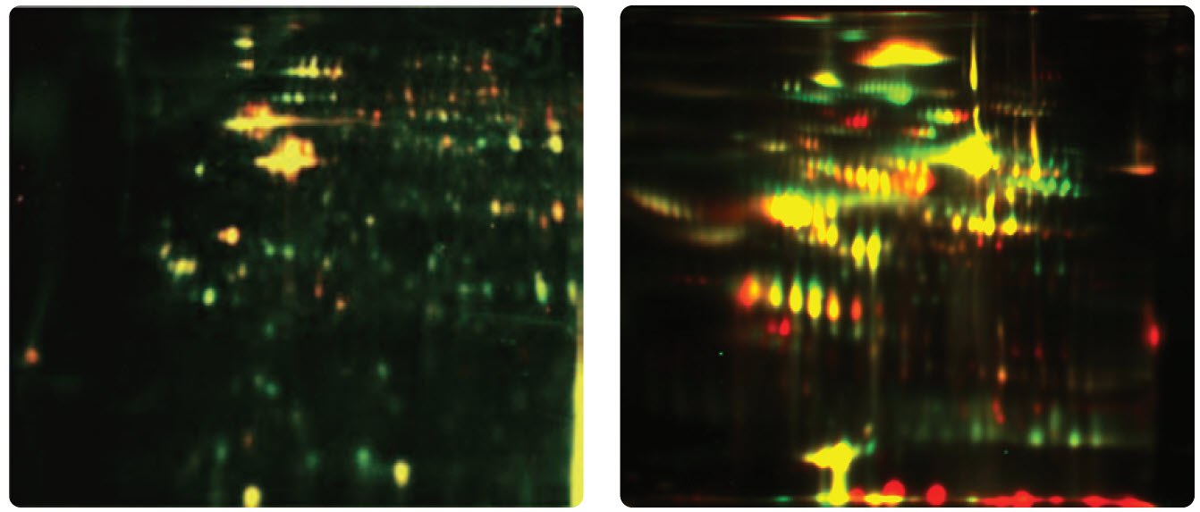 <b>Left</b>: Differential protein expression analysis in cultured cells for cancer biomarker research. Green represents more abundant proteins in normal cells. Red represents cancer-specific protein spots. Yellow represents the overlap in protein expression. <b>Right</b>: Differential protein expression in plasma samples. Differential Protein Expression in Cells and Plasma Samples