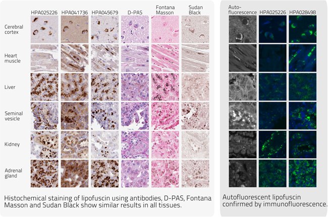 Collection of Proteins in Lipofuscin Collection of Proteins in Lipofuscin