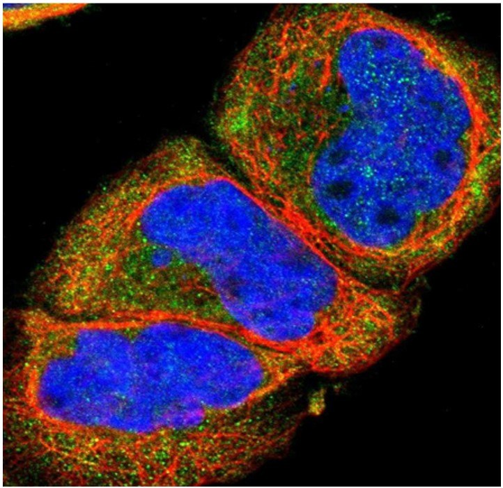 Anti-SSTR2 Antibody Immunofluorescent staining of human cell line A-431 with anti-SSTR2 polyclonal antibody (Cat. No. HPA007264) shows localization to cytosol, in green. Microtubules are shown in red and nuclei in blue.