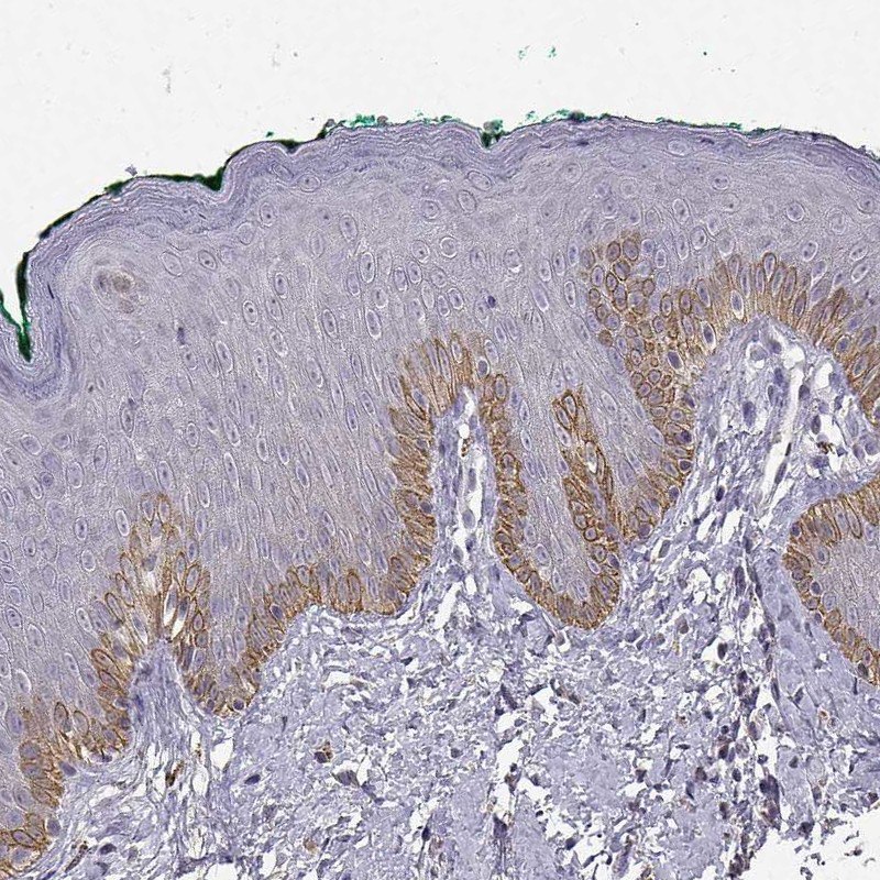 Anti-TACR1 Antibody Immunohistochemical staining of human skin with anti-TACR1 polyclonal antibody (Cat. No. HPA074573) shows strong cytoplasmic positivity in epidermal cells in the basal layer.