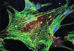 Immunofluorescence. Primary human osteoblast cells labeled with Anti- Vinculin Immunofluorescence. Primary human osteoblast cells labeled with Anti- Vinculin