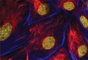Immunofluorescence. Imna(-/-) mouse embryonic fibroblasts stained with Monoclonal Anti-Vimentin Immunofluorescence. Imna(-/-) mouse embryonic fibroblasts stained with Monoclonal Anti-Vimentin