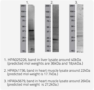 Proteins Within lipofuscin Proteins with Lipofuscin