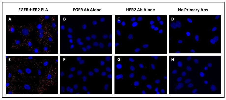 Detection of EGF-induced EGFR:HER2 dimerization using Duolink® PLA Detection of EGF-induced EGFR:HER2 dimerization using Duolink® PLA