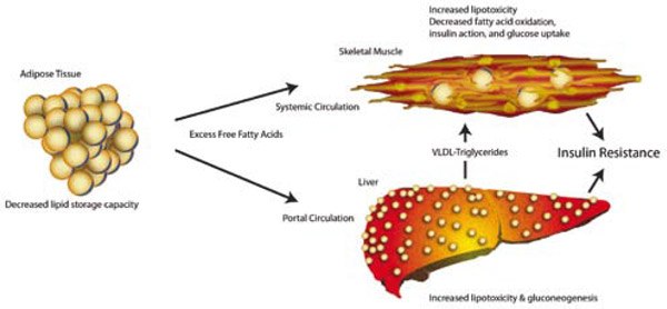 Adipose Expandability Hypothesis Adipose Expandability Hypothesis