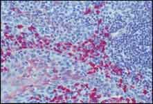 Formalin-fixed, paraffin-embedded section of human tonsil stained with Monoclonal Anti-Human IgA and an Anti-Mouse IgG ALP Conjugate using SIGMAFAST™ Fast Red TR/Naphthol AS-MX Tablets (Cat. No. <a href="/product/sigma/f4523">F4523</a>) as substrate. 40x Colorimetric immunohistochemical detection of Alkaline Phosphatase