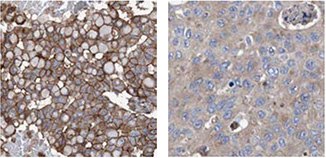 anti-klhl26-antibody anti-klhl26-antibody