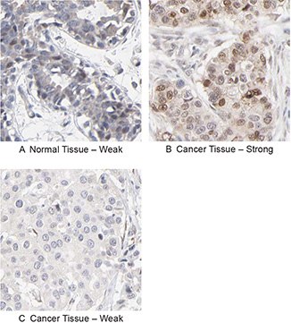 RBM3 Antibody RBM3 Antibody