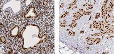 Estrogen Receptor-2 Estrogen Receptor-2