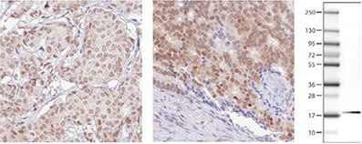 RBM3 Antibodies RBM3 Antibodies