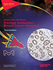 prestige antibodies prestige antibodies