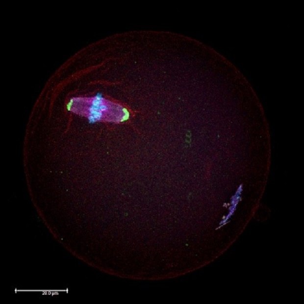Microscopic image of a mouse oocyte Microscopic image of mouse oocyte in the meiotic metaphase II stage.