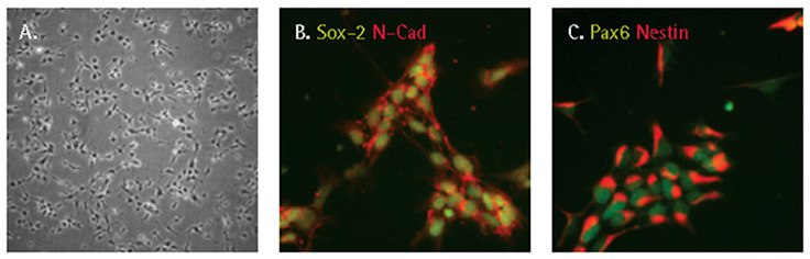 Characterization of iPSC derived neural progenitor cells Characterization of iPSC derived neural progenitor cells