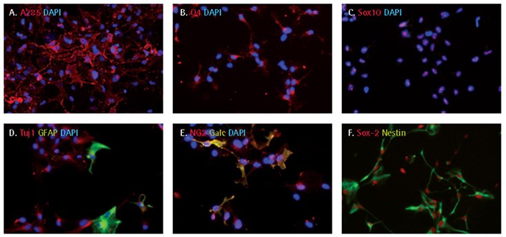 Oligodendrocyte differentiation of iPS cell derived NPCs Oligodendrocyte differentiation of iPS cell derived NPCs