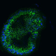 E-Cad/DAPI E-Cad/DAPI