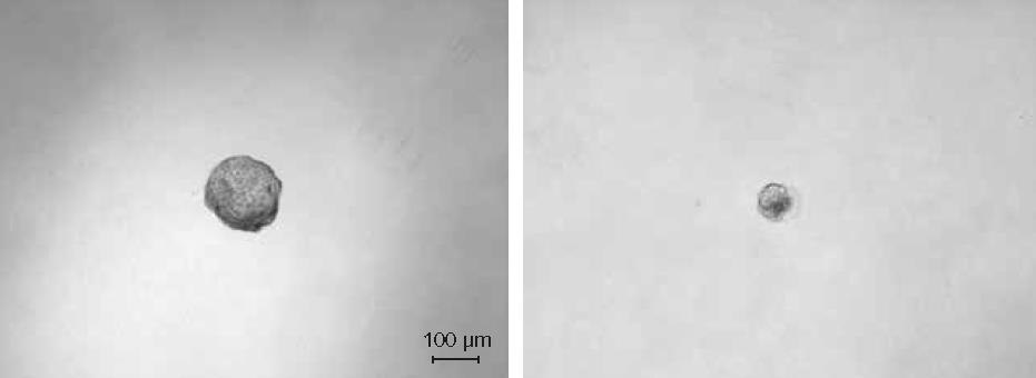 <b>Expected results from an in vitro spheroid formation assay.</b> A) Positive tumorsphere derived from a single MCF-7 cell larger than the 150 µm cutoff size. B) Negative tumorsphere derived from a single MCF-7 cell smaller than the 150 µm cutoff size. Expected results from an in vitro spheroid formation assay