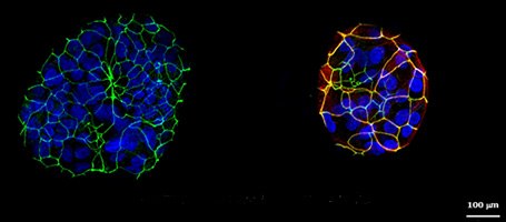 Generation of apical-out gastric organoids Generation of apical-out gastric organoids