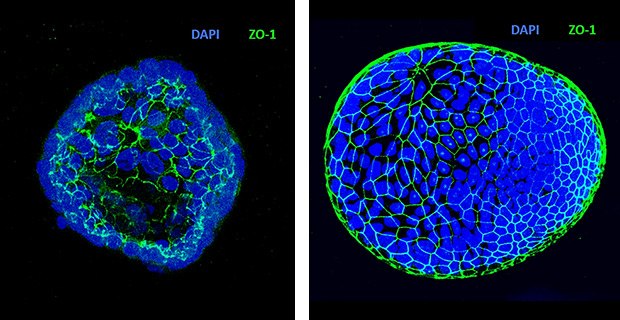 Generation of apical-out organoids : Apical-out Human Colon Organoids Generation.