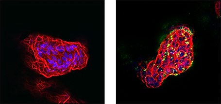 H. pylori infection of apical-out gastric organoids H. pylori infection of apical-out gastric organoids