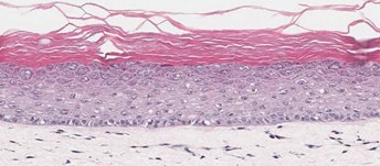 In-Vitro Organotypic Skin Culture-a In-Vitro Organotypic Skin Culture (A)
