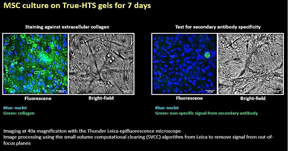 Microscopy images of human adipose MSCs cultured in 3D using TrueGel3D HTS hydrogel plates. Keywords: MSC, mesenchymal stem cells, truegel3d Microscopy images of human adipose MSCs cultured in 3D using TrueGel3D HTS hydrogel plates. Keywords: MSC, mesenchymal stem cells, truegel3d
