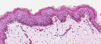 Neonatal Skin Tissue-b Neonatal Skin Tissue (B)