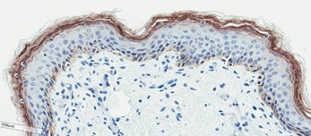 Neonatal Skin Tissue d Neonatal Skin Tissue (D)