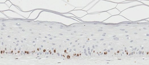 Organotypic skin models (brown) Organotypic skin models contain actively proliferating keratinocytes. (A)