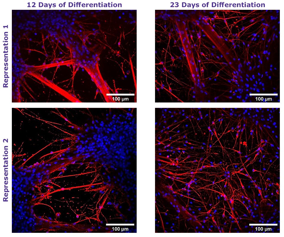 Neural Differentiation of Human NSCs using TrueGel3D HTS Hydrogel Plates Microscopy images of human NSCs cultured in 3D using TrueGel3D HTS hydrogel plates