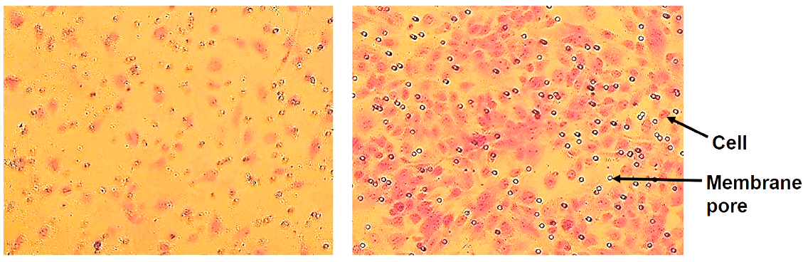 In vitro cell migration of endothelial cells stimulated by VEGF. In vitro cell migration of endothelial cells stimulated by VEGF.