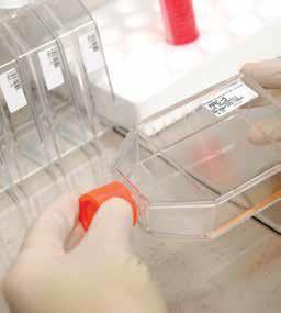 Subculture of adherent cell mono layer cell monolayer