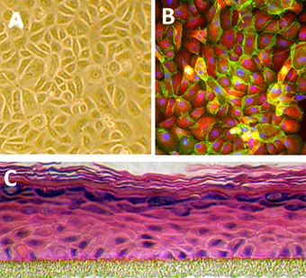 Human Epidermal Keratinocytes Human Epidermal Keratinocytes